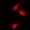 Phospholipase C Gamma 1 antibody, GTX32238, GeneTex, Immunofluorescence image 