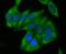 Acyl-CoA Dehydrogenase Medium Chain antibody, NBP2-80447, Novus Biologicals, Immunocytochemistry image 
