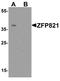 Zinc Finger Protein 821 antibody, TA326674, Origene, Western Blot image 