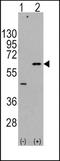 RAC-gamma serine/threonine-protein kinase antibody, TA302230, Origene, Western Blot image 