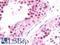 NIMA Related Kinase 7 antibody, LS-B10926, Lifespan Biosciences, Immunohistochemistry paraffin image 