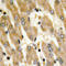 Fibronectin 1 antibody, LS-C353995, Lifespan Biosciences, Immunohistochemistry paraffin image 