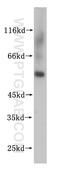 Nucleoporin 54 antibody, 16232-1-AP, Proteintech Group, Western Blot image 