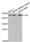 Lumican antibody, A5352, ABclonal Technology, Western Blot image 