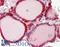 Calreticulin antibody, LS-B11539, Lifespan Biosciences, Immunohistochemistry paraffin image 