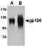 HIV gp120 antibody, orb75051, Biorbyt, Western Blot image 