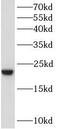 BAALC Binder Of MAP3K1 And KLF4 antibody, FNab00779, FineTest, Western Blot image 