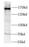 Structural Maintenance Of Chromosomes 1A antibody, FNab08016, FineTest, Western Blot image 