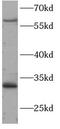 Heat Shock Transcription Factor 2 antibody, FNab10025, FineTest, Western Blot image 