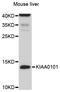 PCNA Clamp Associated Factor antibody, STJ112394, St John
