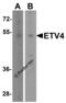 ETS Variant 4 antibody, 8535, ProSci, Western Blot image 