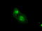 Serine/threonine-protein kinase PRKY antibody, TA500564, Origene, Immunofluorescence image 