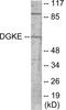 Diacylglycerol Kinase Epsilon antibody, EKC1740, Boster Biological Technology, Western Blot image 