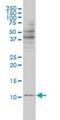 Barrier-to-autointegration factor antibody, orb89739, Biorbyt, Western Blot image 