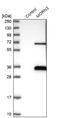 MORN Repeat Containing 3 antibody, NBP2-30560, Novus Biologicals, Western Blot image 