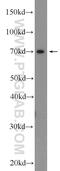 Transient Receptor Potential Cation Channel Subfamily V Member 6 antibody, 13411-1-AP, Proteintech Group, Western Blot image 