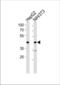 Nuclear Receptor Subfamily 2 Group F Member 2 antibody, TA324540, Origene, Western Blot image 