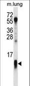 Cytochrome C Oxidase Subunit 7A1 antibody, LS-C166969, Lifespan Biosciences, Western Blot image 