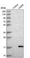 Lactalbumin Alpha antibody, PA5-65052, Invitrogen Antibodies, Western Blot image 