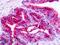 Brain-specific angiogenesis inhibitor 1 antibody, LS-A6707, Lifespan Biosciences, Immunohistochemistry paraffin image 
