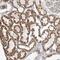 Zinc Finger FYVE-Type Containing 16 antibody, NBP1-81516, Novus Biologicals, Immunohistochemistry paraffin image 