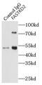 FAST Kinase Domains 2 antibody, FNab03020, FineTest, Immunoprecipitation image 