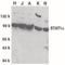 Signal Transducer And Activator Of Transcription 1 antibody, orb86788, Biorbyt, Western Blot image 