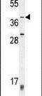 Zinc Finger Protein 763 antibody, PA5-24063, Invitrogen Antibodies, Western Blot image 