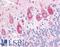 Dual Specificity Phosphatase 23 antibody, LS-A6806, Lifespan Biosciences, Immunohistochemistry paraffin image 