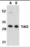 CD267 antibody, 2395, ProSci Inc, Western Blot image 