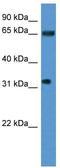 Serine/Arginine Repetitive Matrix 4 antibody, TA342932, Origene, Western Blot image 
