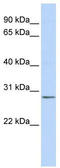 Inositol Monophosphatase 2 antibody, TA344408, Origene, Western Blot image 