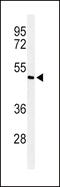 SMAD Family Member 7 antibody, 62-445, ProSci, Western Blot image 