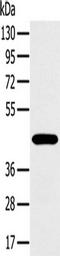 MAGE Family Member A10 antibody, TA350148, Origene, Western Blot image 