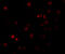 Probable phospholipid-transporting ATPase IF antibody, 5857, ProSci Inc, Immunofluorescence image 