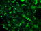 ATP Synthase F1 Subunit Beta antibody, TA500834, Origene, Immunofluorescence image 