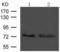 Glutamate Decarboxylase 2 antibody, TA323560, Origene, Western Blot image 