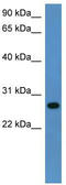 Cytochrome B5 Reductase 2 antibody, TA336093, Origene, Western Blot image 