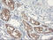 SERPINB2 antibody, M03427, Boster Biological Technology, Immunohistochemistry paraffin image 