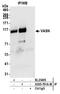 Vasorin antibody, A305-791A-M, Bethyl Labs, Immunoprecipitation image 
