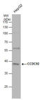 Coiled-Coil Domain Containing 92 antibody, GTX120767, GeneTex, Western Blot image 
