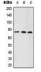 ATP Binding Cassette Subfamily D Member 1 antibody, GTX54936, GeneTex, Western Blot image 