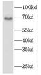 Fibulin 5 antibody, FNab03125, FineTest, Western Blot image 