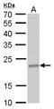Twisted Gastrulation BMP Signaling Modulator 1 antibody, GTX117899, GeneTex, Western Blot image 