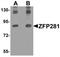 Zinc Finger Protein 281 antibody, TA319862, Origene, Western Blot image 
