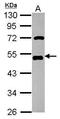Transcription Factor AP-2 Alpha antibody, GTX113564, GeneTex, Western Blot image 