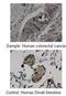 Matrix Metallopeptidase 19 antibody, GTX77827, GeneTex, Immunohistochemistry paraffin image 