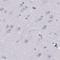 WAP Four-Disulfide Core Domain 8 antibody, NBP2-62608, Novus Biologicals, Immunohistochemistry paraffin image 