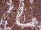Ret Proto-Oncogene antibody, LS-C339731, Lifespan Biosciences, Immunohistochemistry paraffin image 