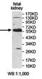 EGF Like Domain Multiple 6 antibody, orb78333, Biorbyt, Western Blot image 